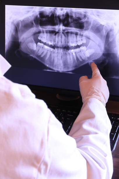 Best Emergency Dental Extractions in Hewitt, TX