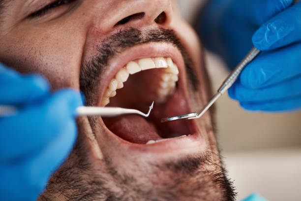 Best Orthodontic Emergency Dentist in Hewitt, TX