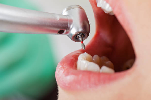 Best Emergency Dentist for Knocked-Out Tooth in Hewitt, TX